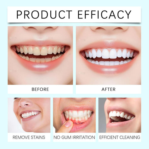 Pasta Dental Blanqueadora con Niacinamida 120G – Sonrisa Más Brillante y Cuidado Diario